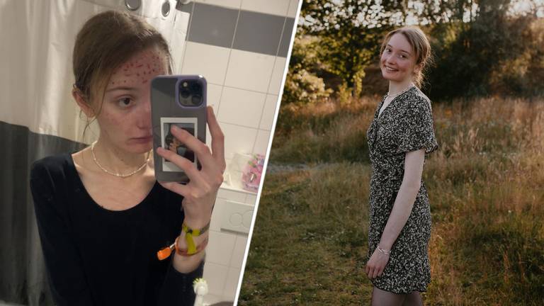 dyleen-22-deelt-haar-eetstoornis-op-social-media-om-anderen-te-helpen