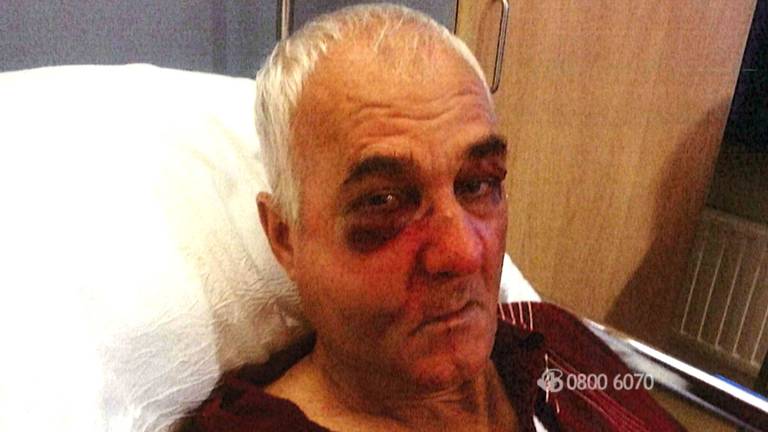 De man brak zijn neus en jukbeenderen (foto: Bureau Brabant)