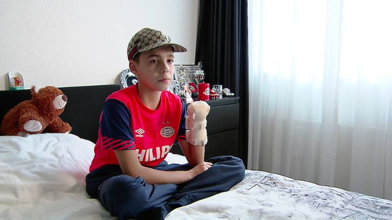 Dani verloor zijn hand door een cobra (foto: Politie)