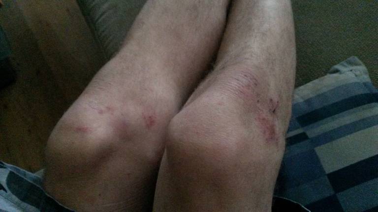 De man doet aangifte van mishandeling