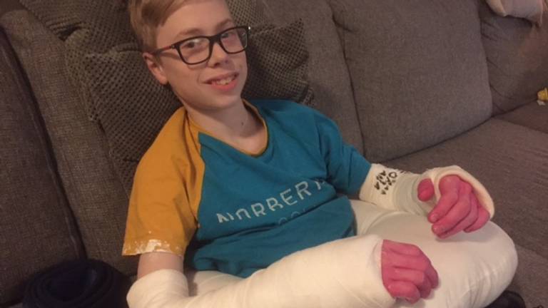 Snookertalent Hans Kuijpers (13) uit Roosendaal mist EK en WK door gebroken polsen