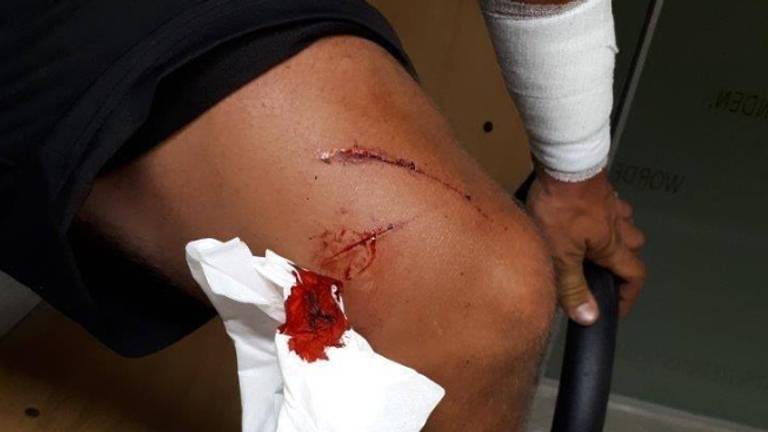 Het slachtoffer werd ook in zijn been geraakt. (Foto: Politie Oss / Facebook)