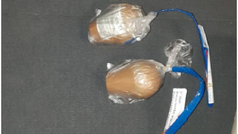 Mortiergranaat Ontplofte In Gezicht Van Vuurwerkslachtoffers Den Bosch Een Van Hen Moet Oog Missen Omroep Brabant