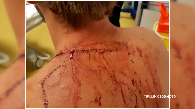 De gehechte wond van een van de slachtoffers (foto: Bureau Brabant).