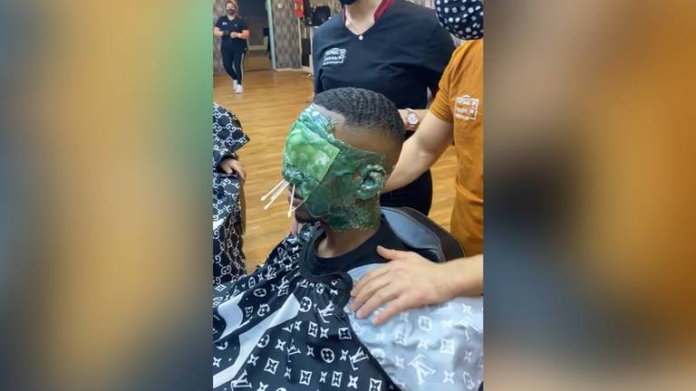 Een filmpje van een complete harsbehandeling van het gezicht is al door meer dan 55 miljoen mensen bekeken. (Foto:Renaz Ismael)
