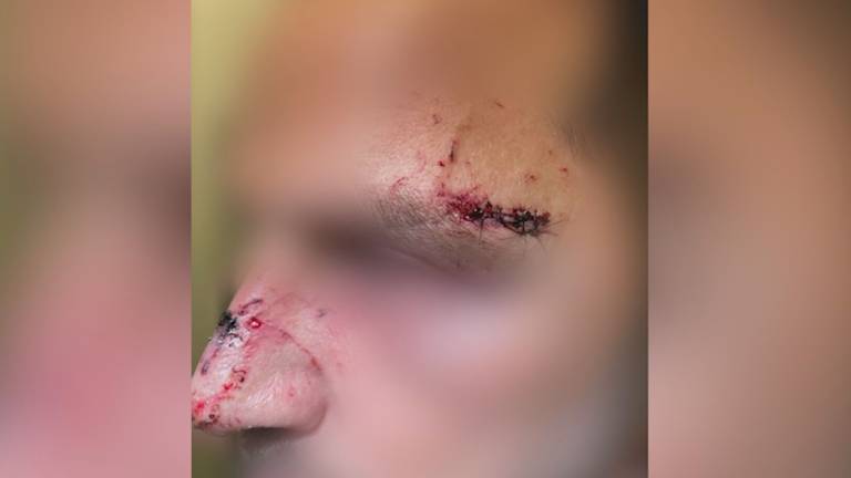 De man werd uit het niets met een glas in zijn gezicht geslagen (foto: Bureau Brabant).