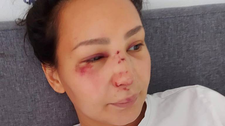 Sylvana (39) bewusteloos geslagen na stapavond, daders filmden mishandeling