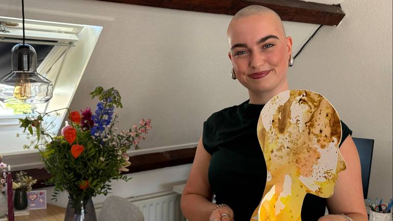 Anne is al sinds haar vijftiende kaal en zet zich nu in voor mensen met alopecia.