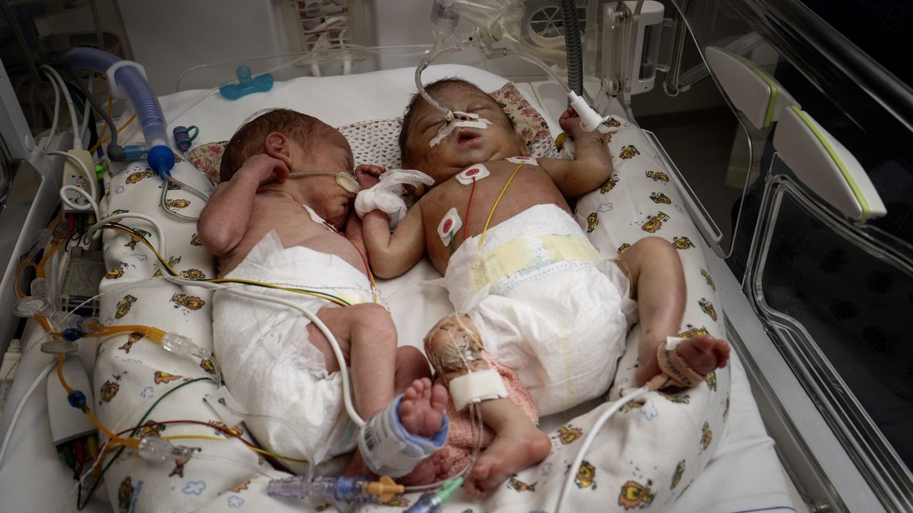 Meike en Sven in de couveuse (foto: Lin's Moments/Make a memory).