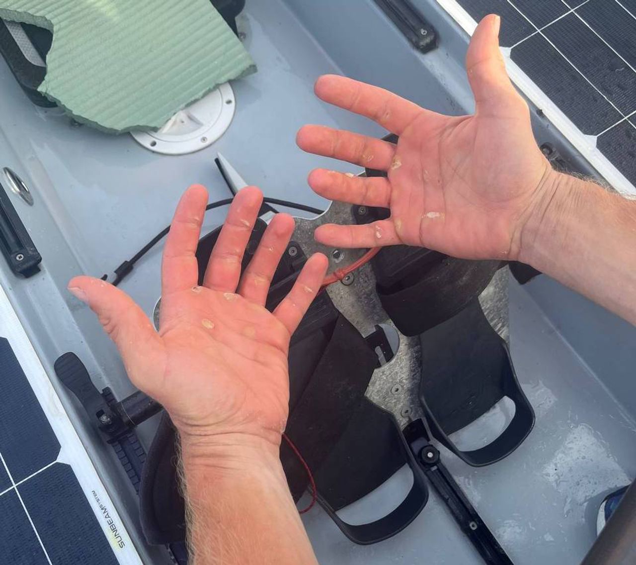 Na drie weken staan de blaren op de handen van de roeiers.