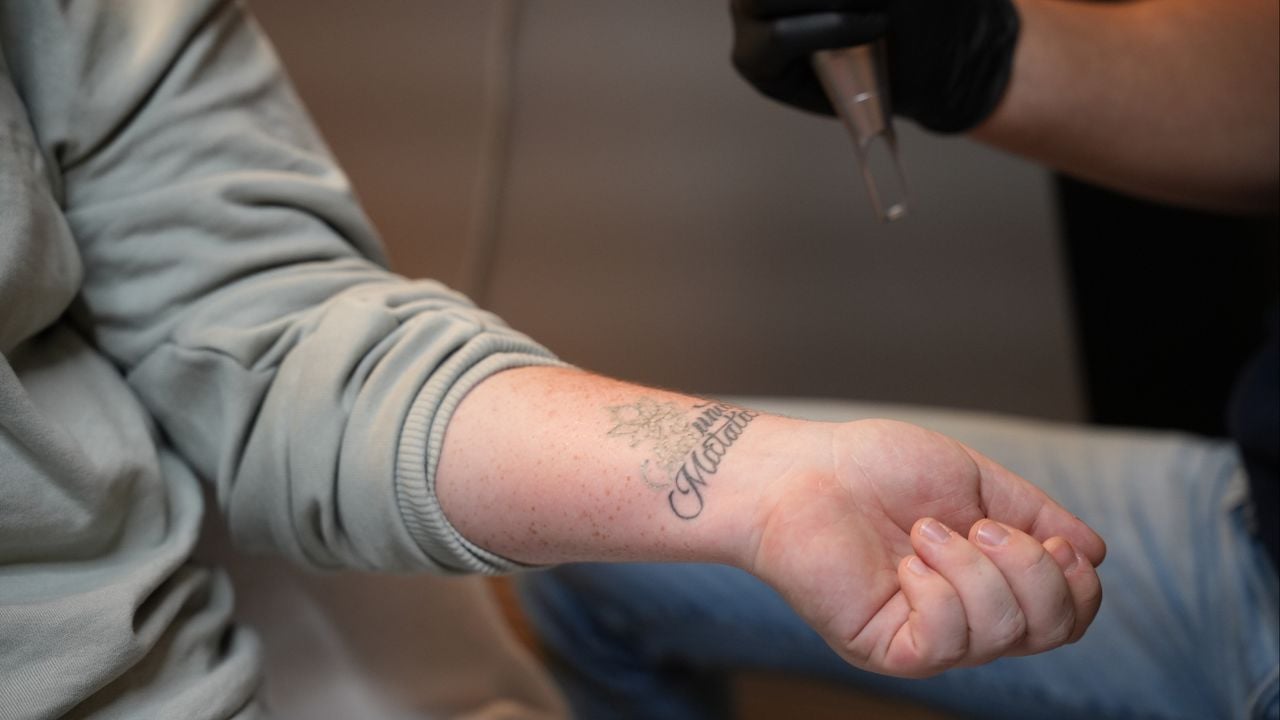 Het weglaseren van een tattoo gaat niet zo makkelijk als het hier misschien lijkt (foto: Rochelle Moes).