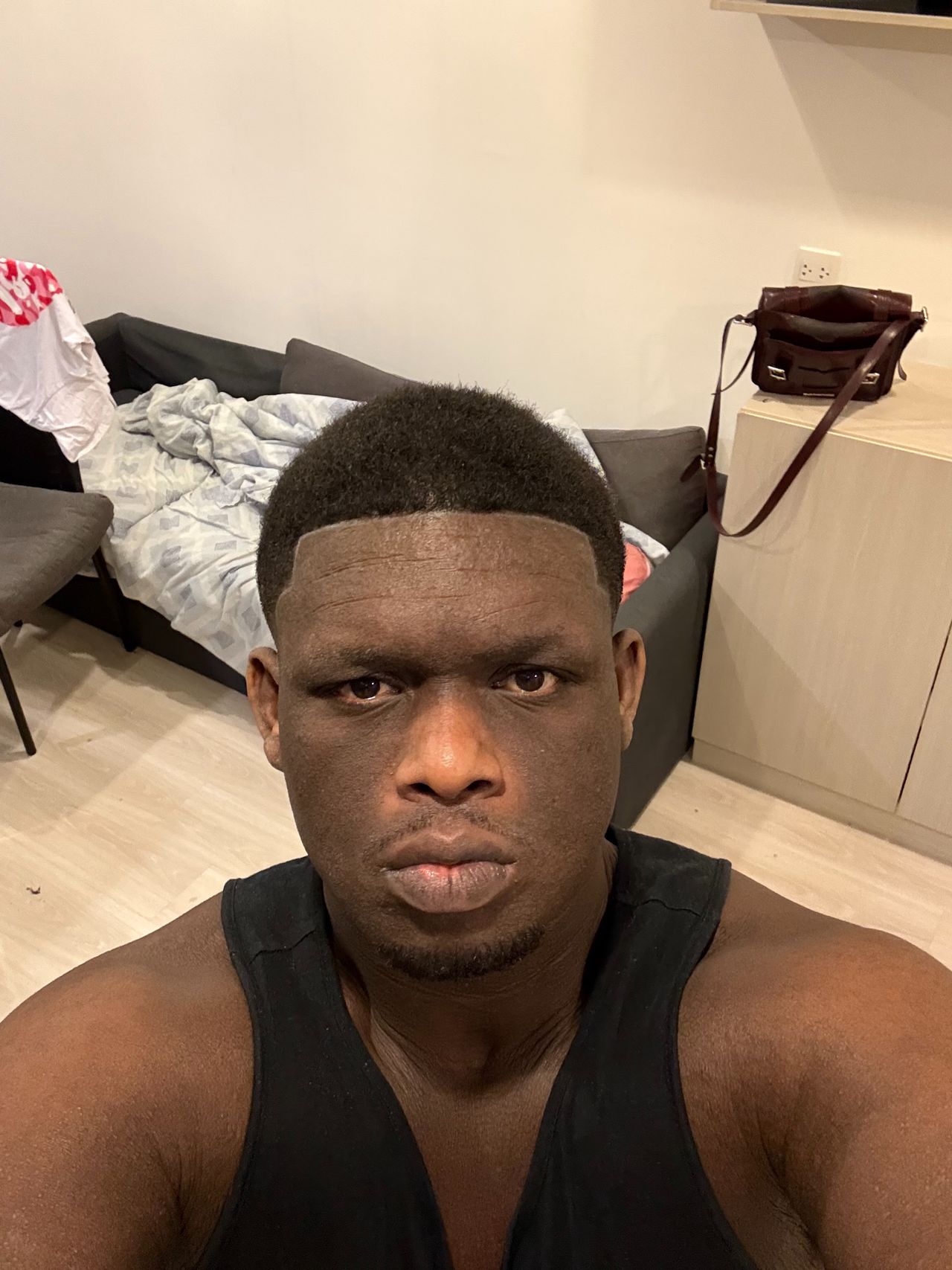 Anneudy na een aantal behandelingen (eigen foto).