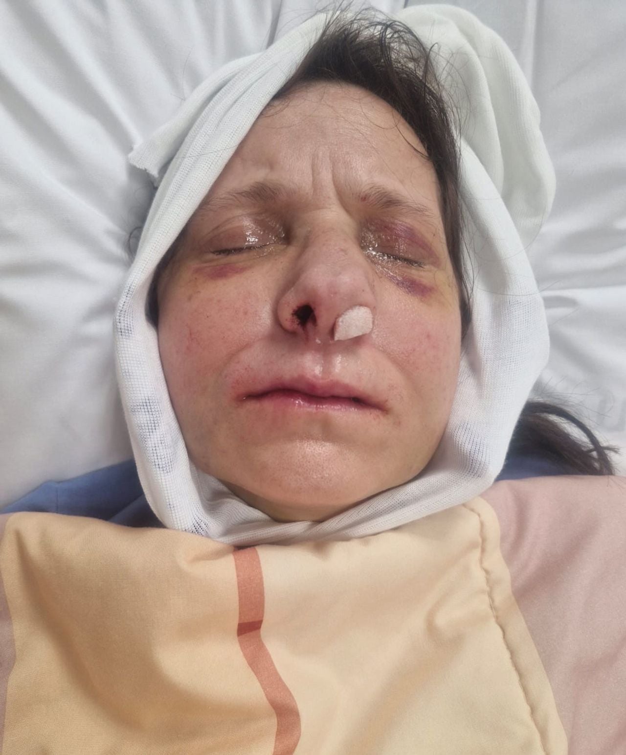 Dorota in het ziekenhuis