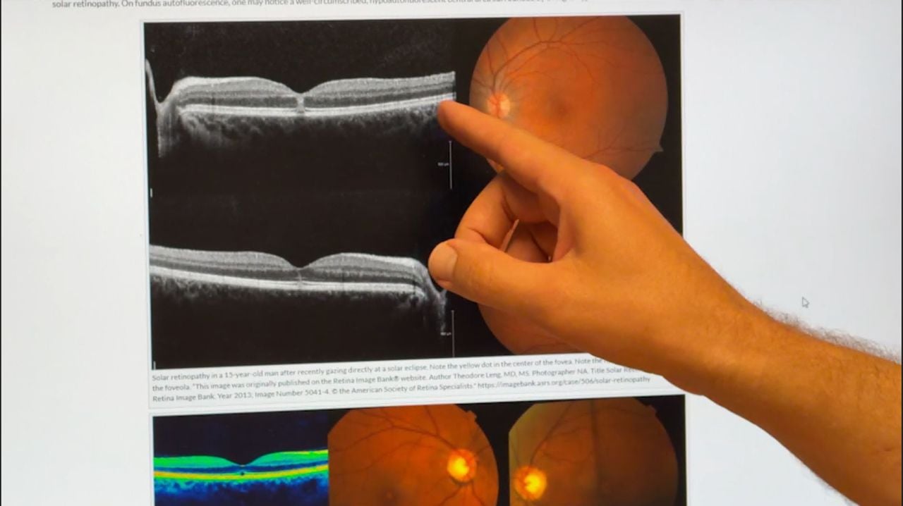 Oogarts Stefan laat zien hoe je oog kan beschadigen door zonlicht (foto: Omroep Brabant)