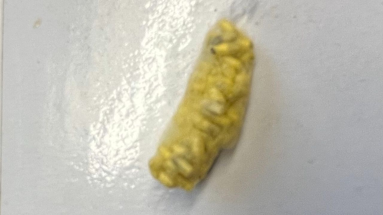 Eitjes van een sluipwesp (foto: Ad Verstijnen).