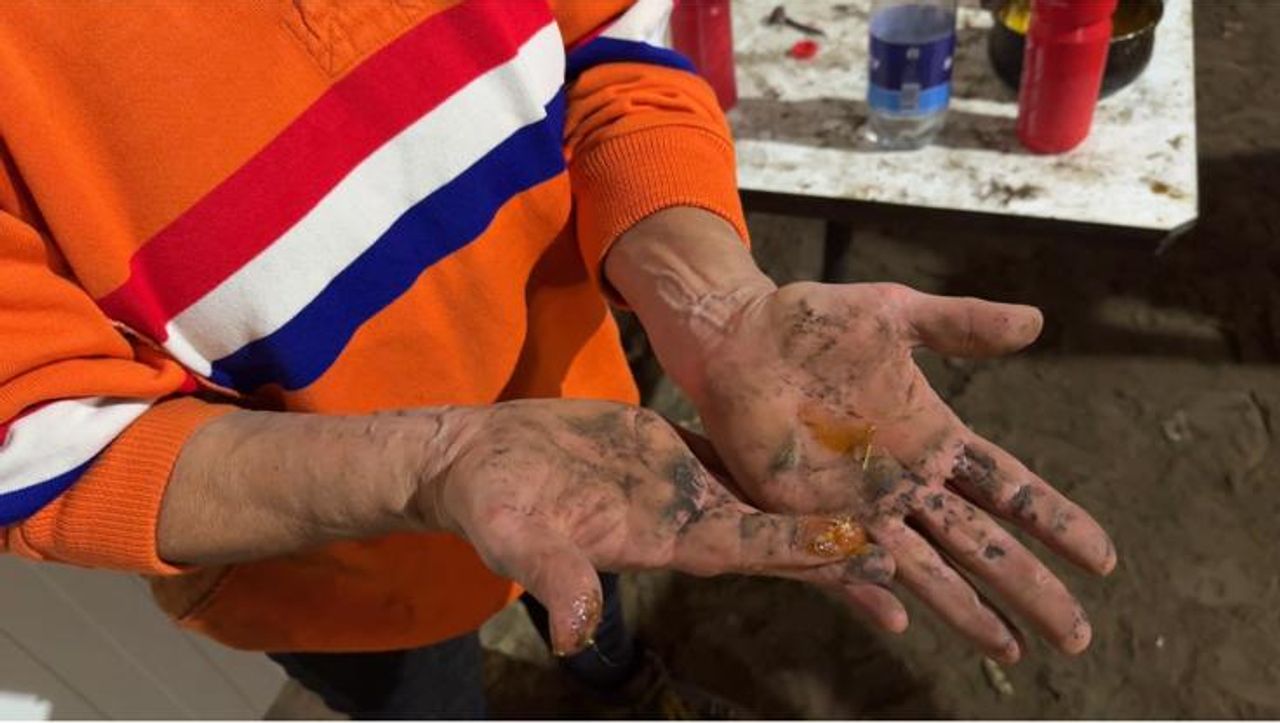 De handen van touwtrekinternational Gisela Kooremans.