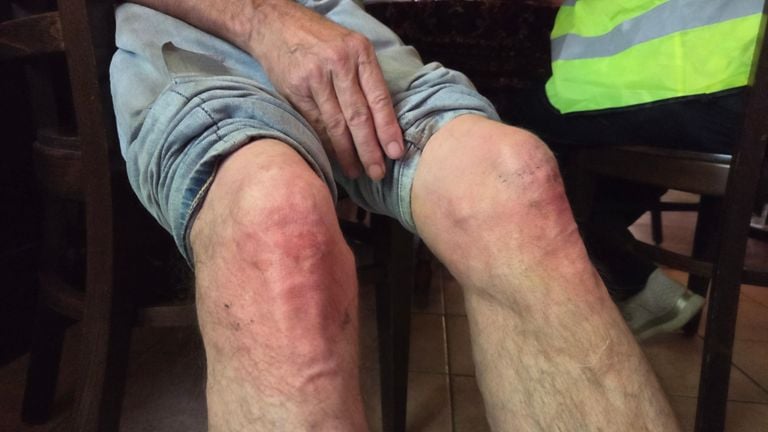 De knieën van Jos (76) na uren kruipen (foto: Noël van Hooft).