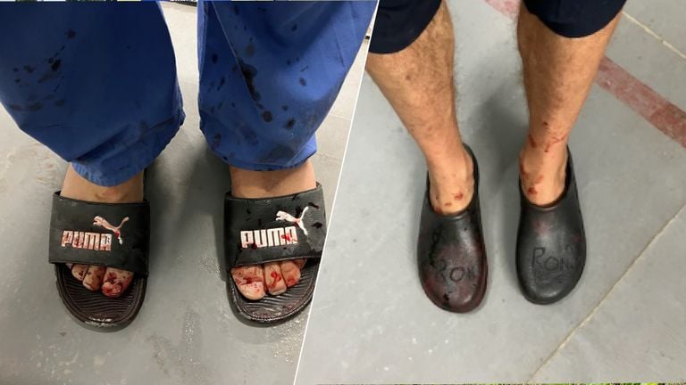 Rons operatieklompen zijn net Gaza gearriveerd, daarvoor leende hij slippers, 'onvoorstelbaar in Nederland' (privéfoto).
