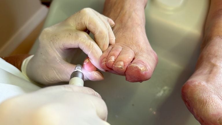 Pedicure Mimi behandelt de voet van klant Netty (foto: Ronald Sträter).