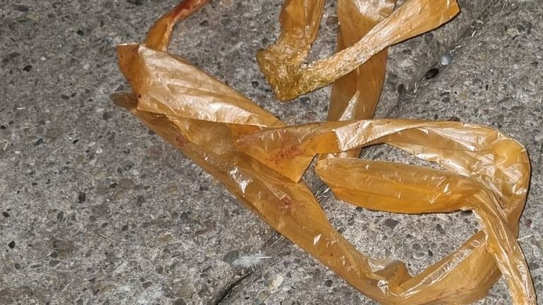 Het hertje had een meter plastic ingeslikt. Foto: Instagram Dierenparken Helmond.