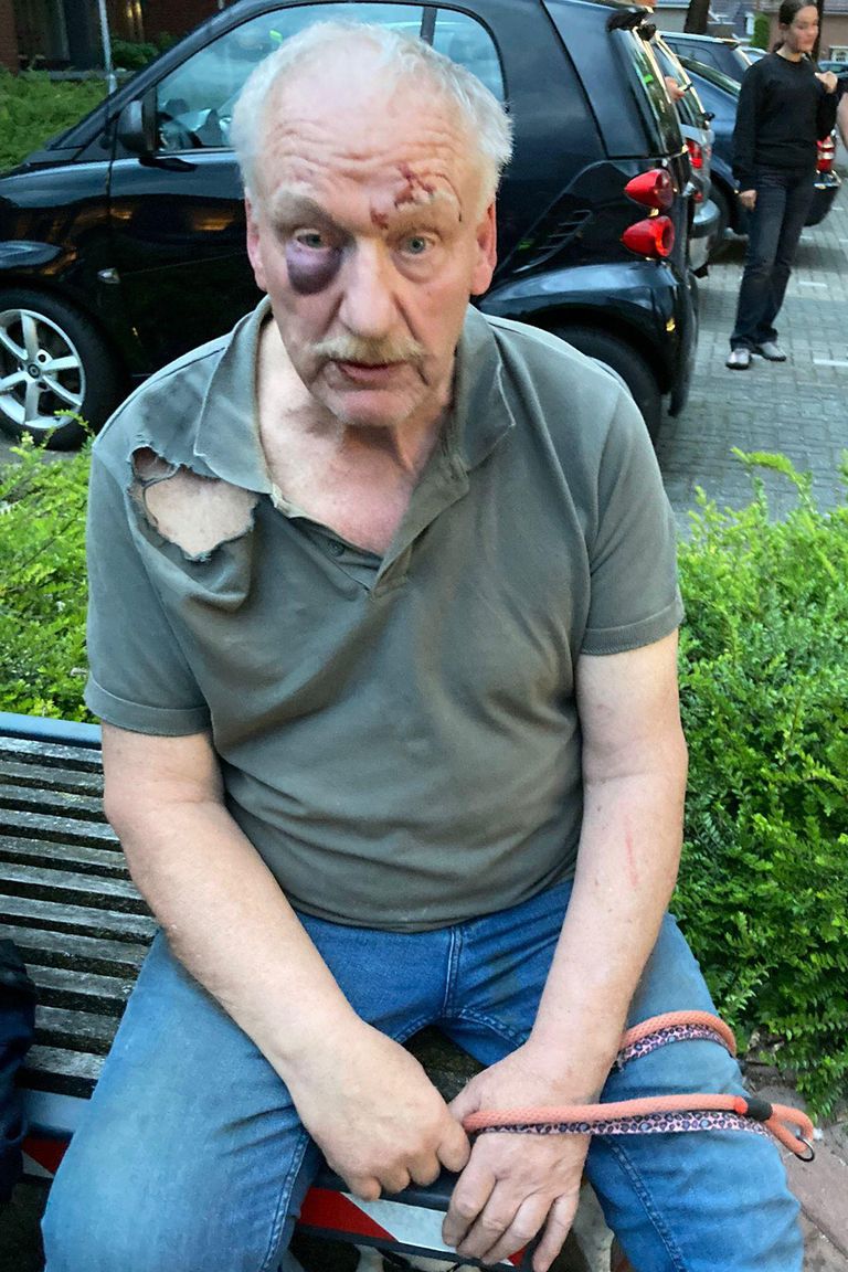 Martin van Wees zondag direct na de mishandeling