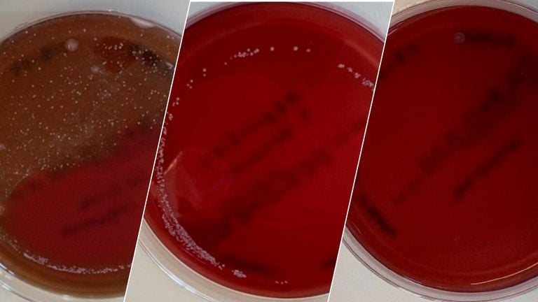 De bacteriën op een plaat van de ongewassen beker (links), de in de spoelbak gewassen beker (midden) en de in de wasstraat gespoelde beker (rechts) (foto: Avans Hogeschool).