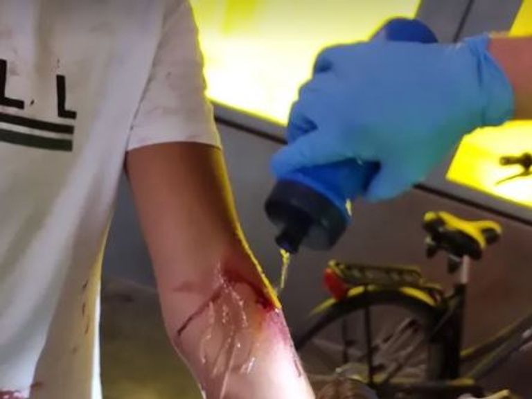 De snijwond (foto: politie_tilburgcentrum/Instagram).