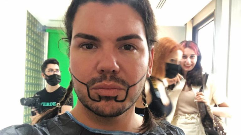 Roy Donders voor de ingreep (foto: Instagram Roy Donders).