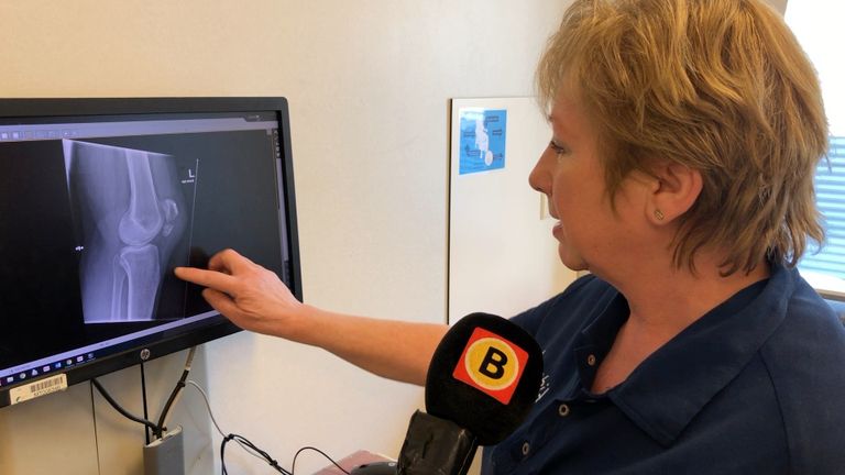 Gipsverbandmeester Clare van Boxsel geeft uitleg bij een breuk in een knie.