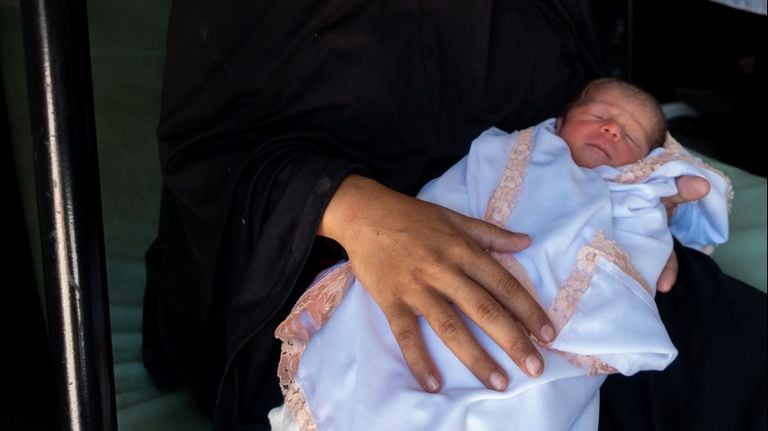 Het pasgeboren baby'tje, dat door de artsen gered werd (foto: UK MED).